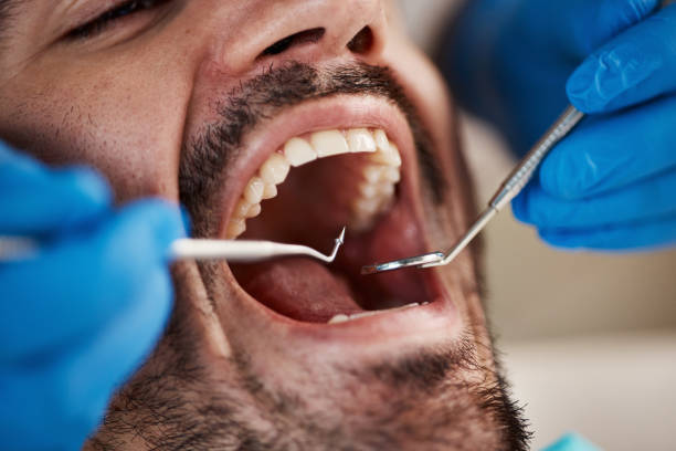 Best Emergency Dental Extractions in Woodward, IA
