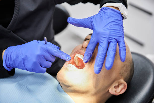 Best Emergency Dentist for Lost Fillings or Crowns in Woodward, IA