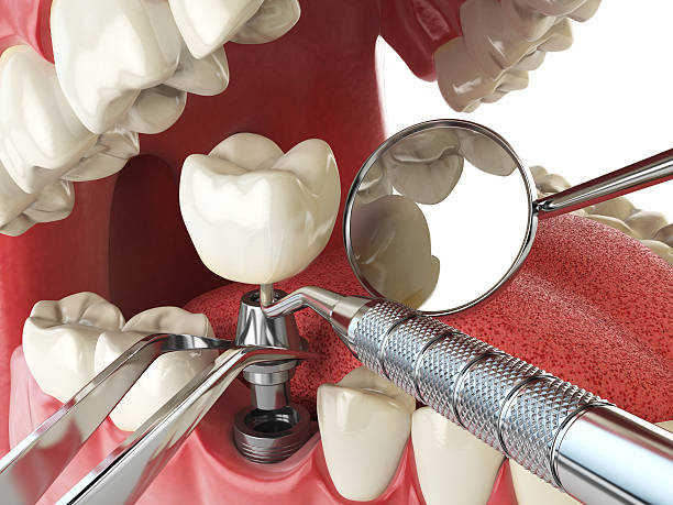 Best Emergency Dentist for Special Needs Patients in Woodward, IA
